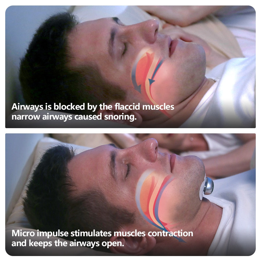 Smart Anti Snoring Device Electronic Muscle Stimulator Pro With 20pcs Conductive Strips