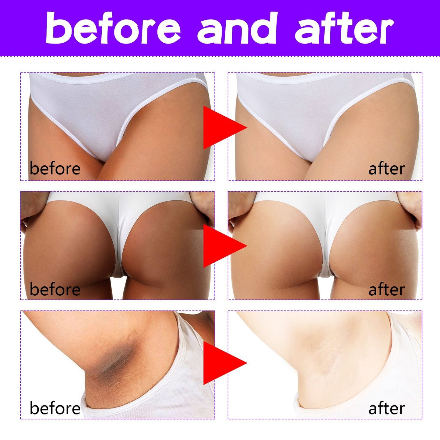OUHOE Inner Thigh Skin Perfecting Cream Lightens Melanin Deposits On Inner Thighs, Moisturizes And Brightens Skin