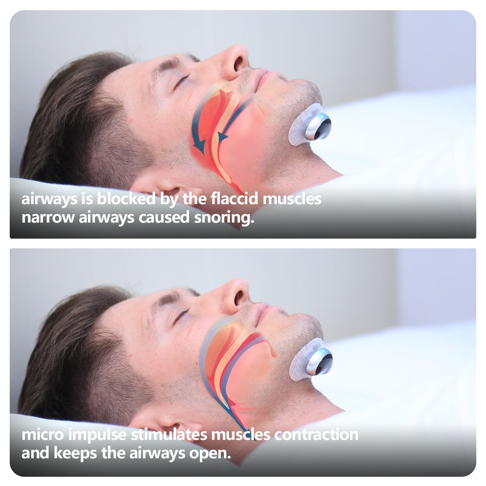 Smart Anti Snoring Device Electronic Muscle Stimulator Plus With 20pcs Conductive Strips