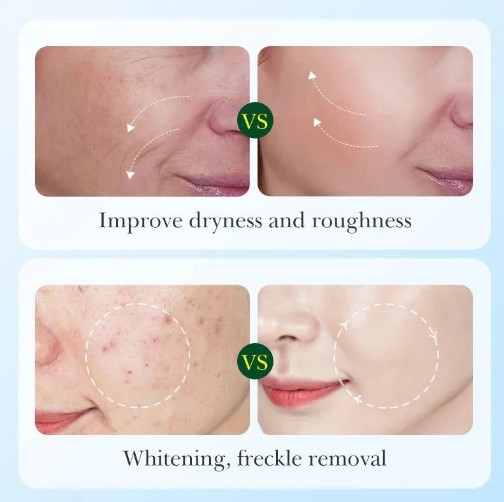 Sadoer - Licorice Root Whitening Skin Care Set